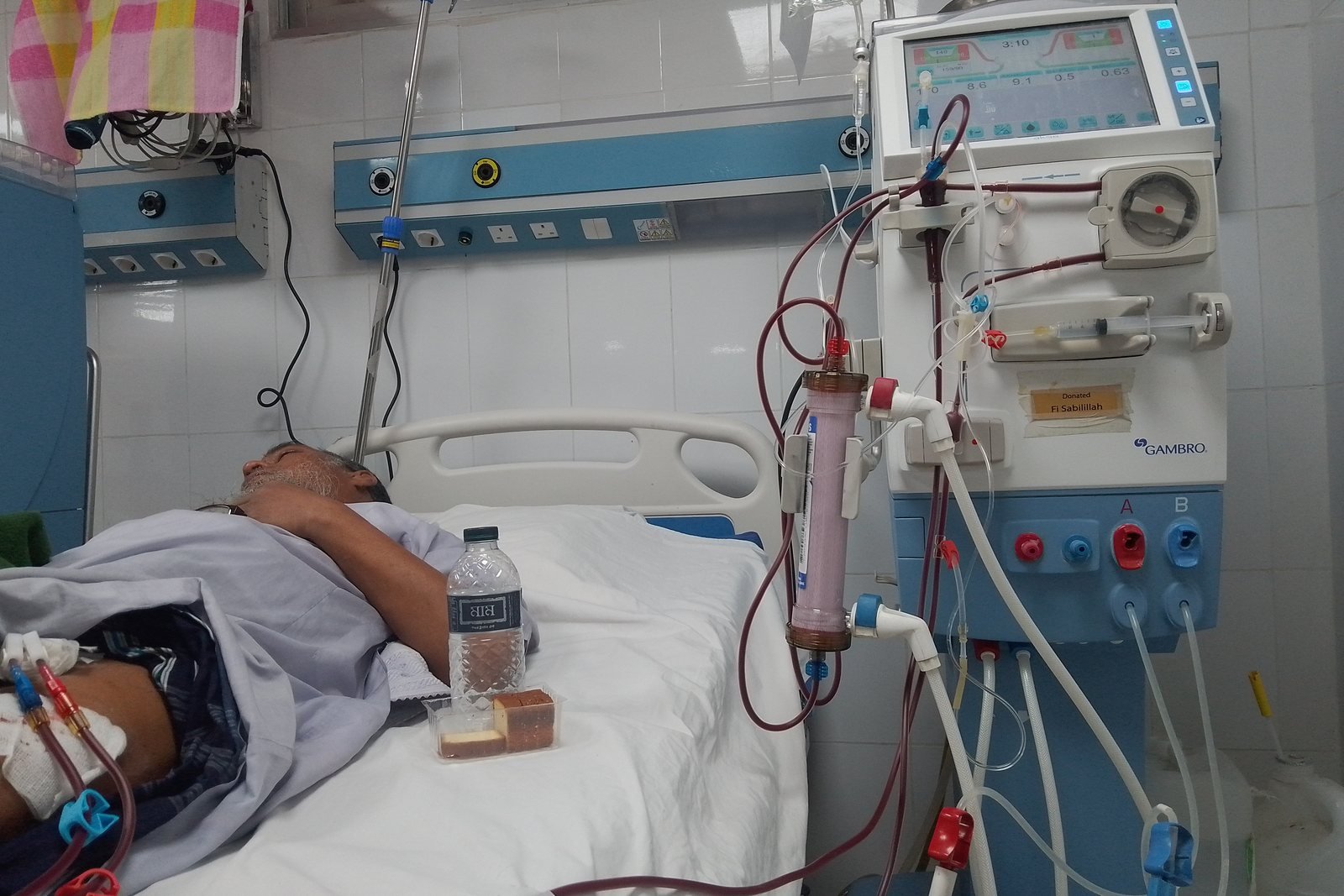 Dialysis treatment